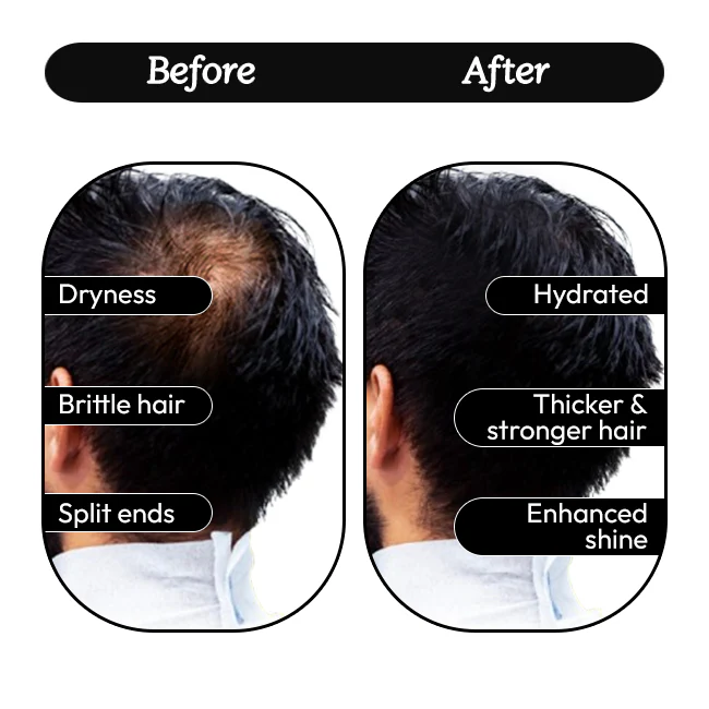 Wayveda Hairfall Control Shampoo-200ml - Image 5